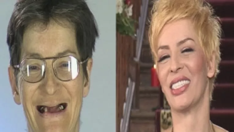 "Frumusete pe muchie de cutit": O femeie intinerita cu 20 de ani